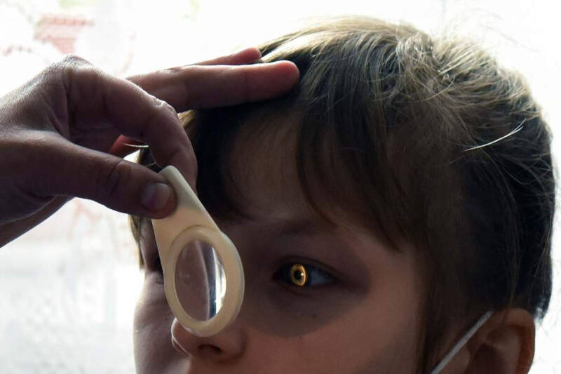 Морковного сока за око: могут ли продукты и упражнения улучшить зрение