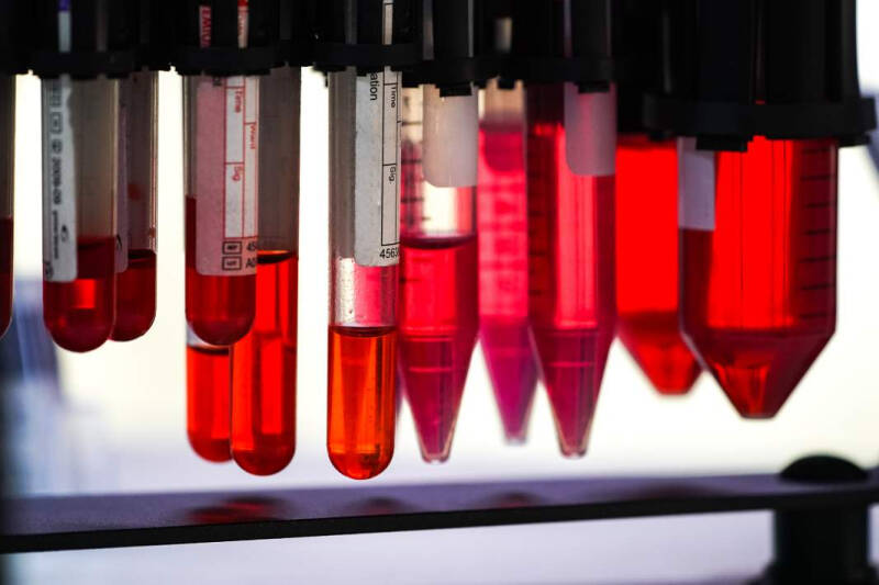 В чем укол: в РФ создали первую безопасную вакцину от оспы обезьян